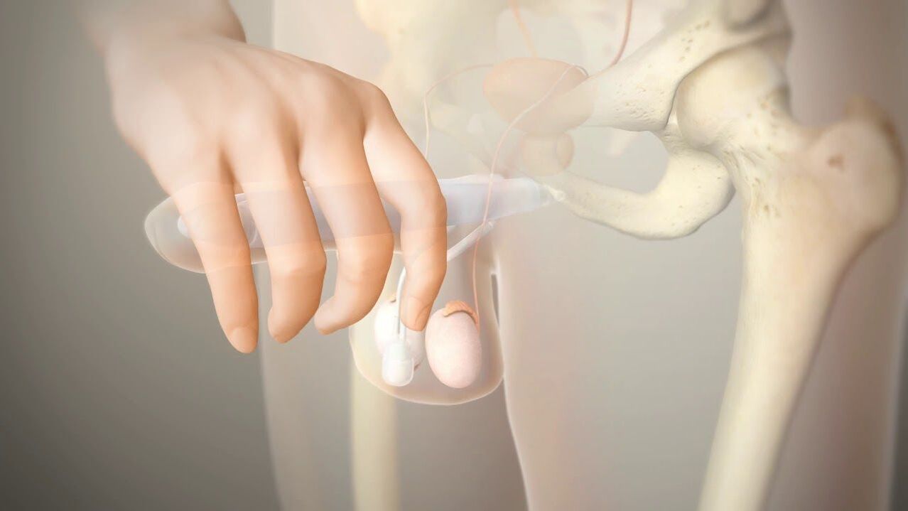 роҳҳои калон кардани penis